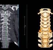 X-Ray, MRI, Medical imaging image